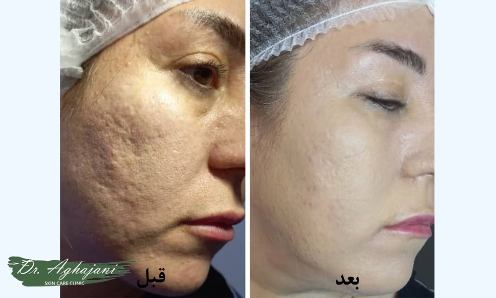 روش درمانی دکتر آقاجانی