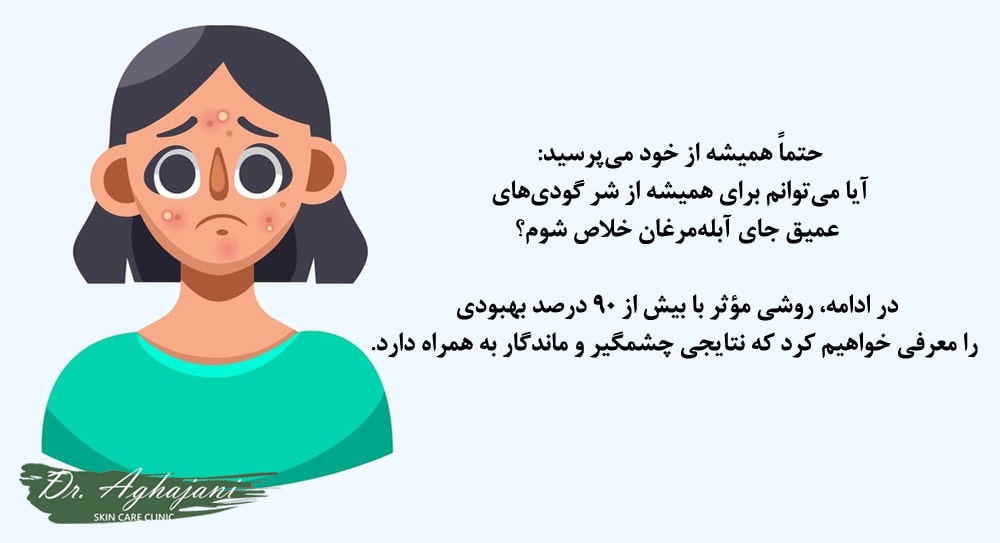 روش های درمان فرورفتگی آبله مرغان