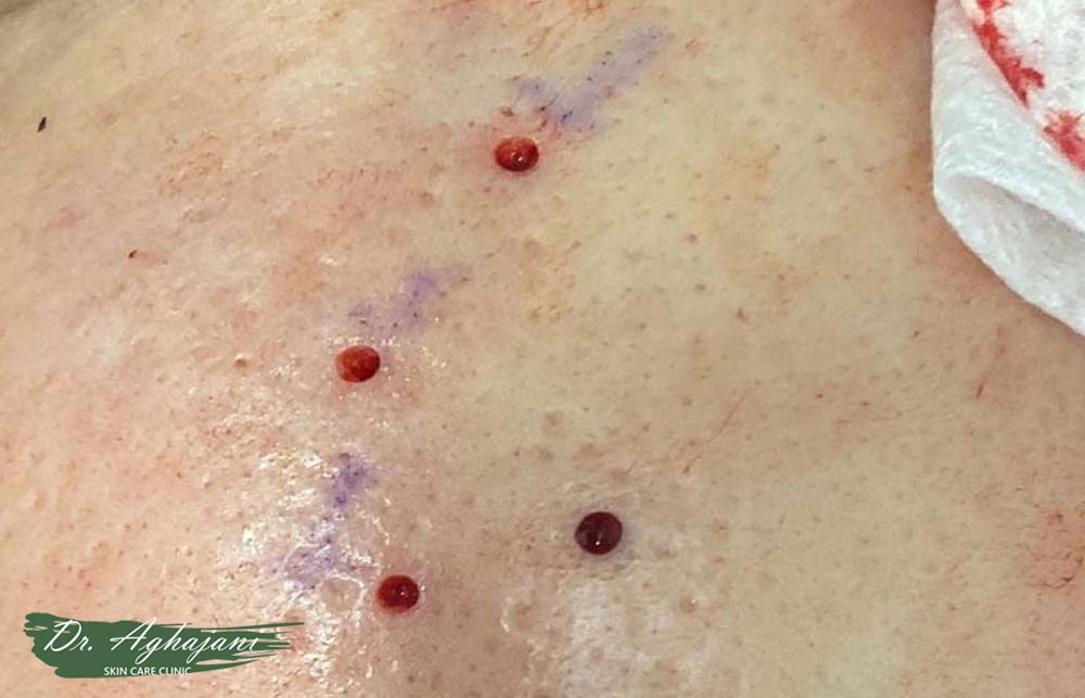 پانچ اکسیژن