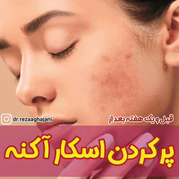 تعداد جلسات و طول درمان