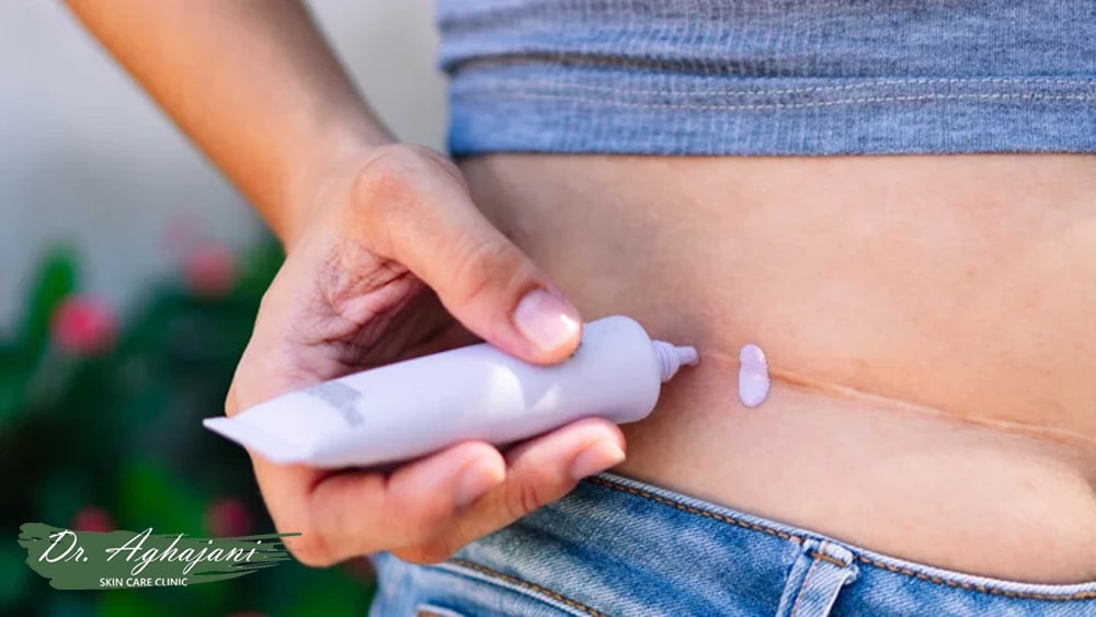 بهترین پماد برای از بین بردن جای زخم