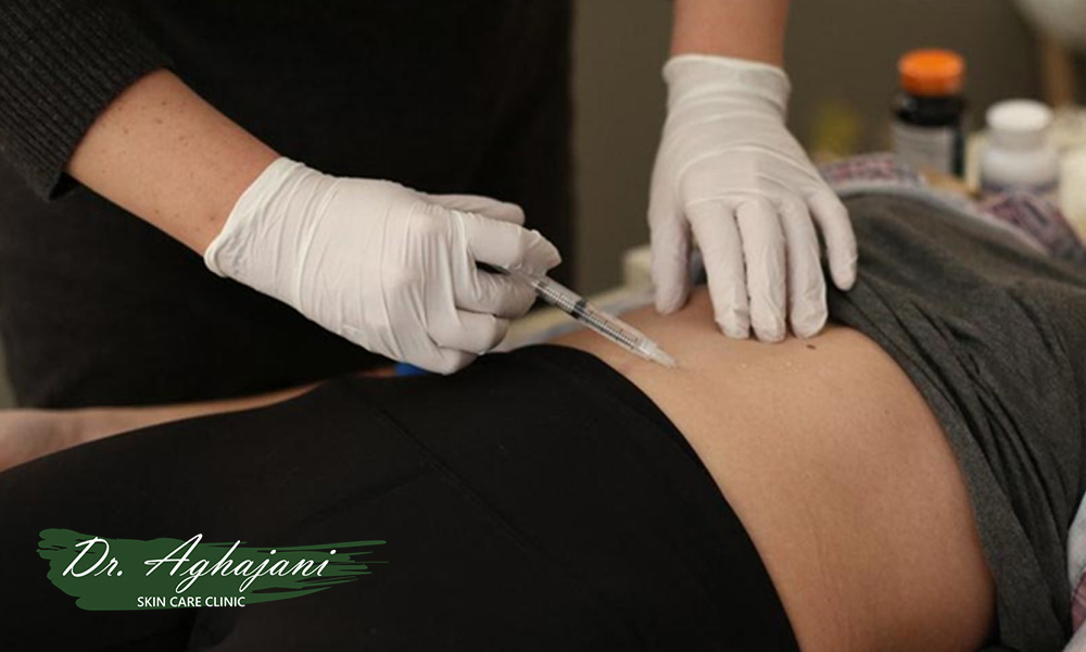 درمان های کلینیکی اسکار هیپرتروفیک