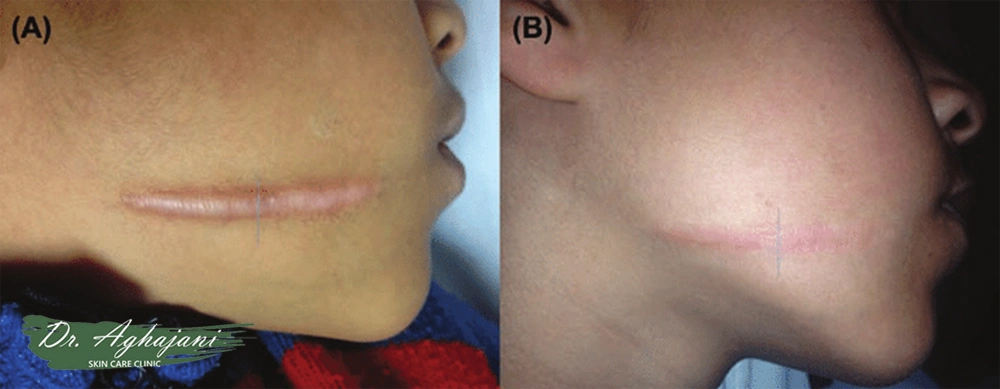 درمانهای کلینیکی مؤثر