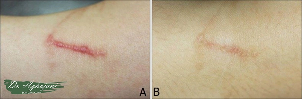 درمانهای خانگی مؤثر
