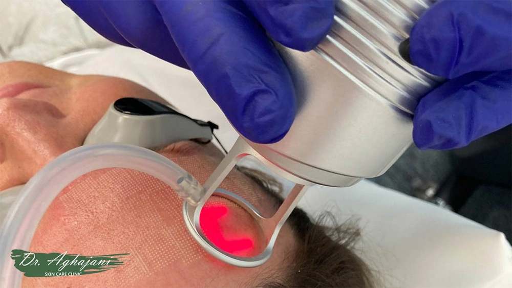 لیزردرمانی