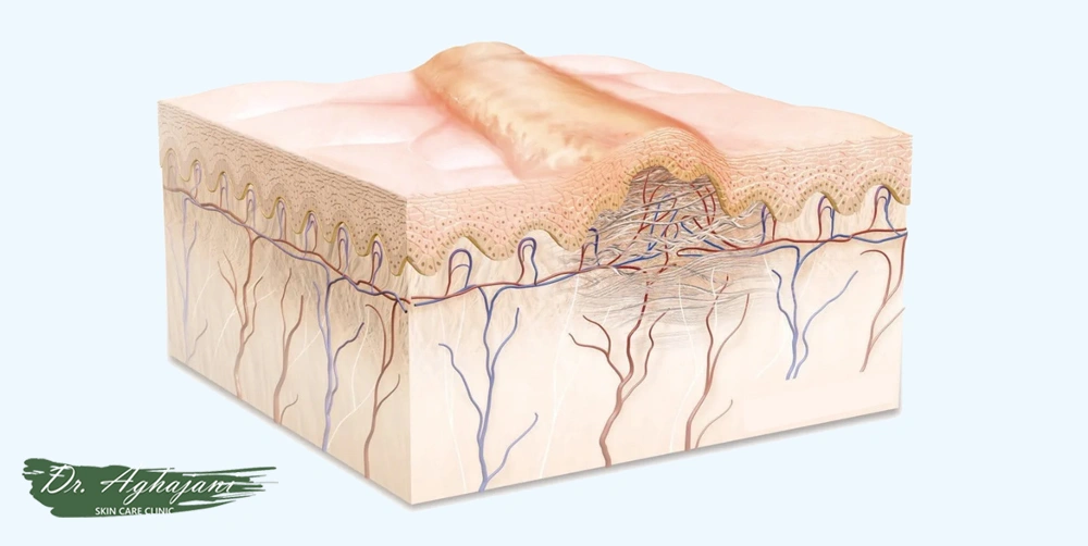 بازسازی پوست