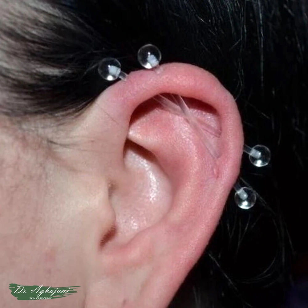 پلاستیکهای مخصوص