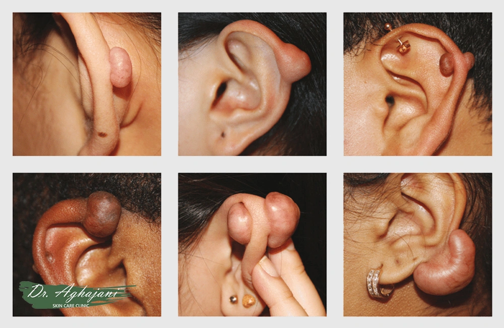 کلوئید واقعی