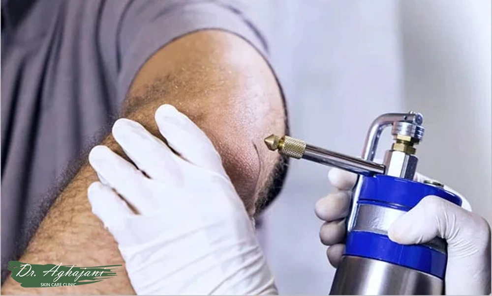 درمان جای زخم و اسکار