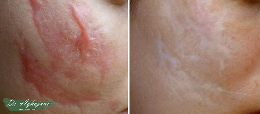 بیماری زمینهای