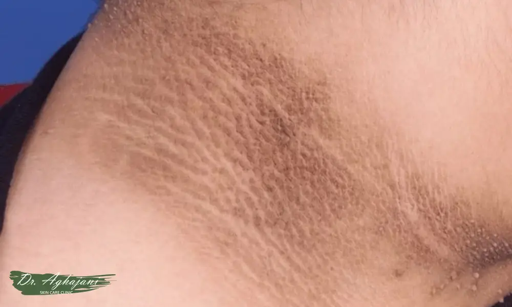 لک مخملی و ضخیم