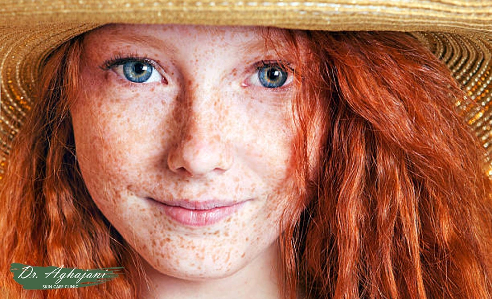 ککومک نوجوانی