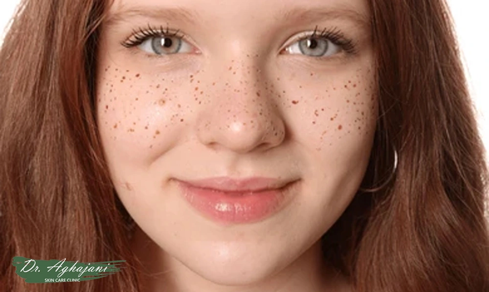 ککومک نوجوانی