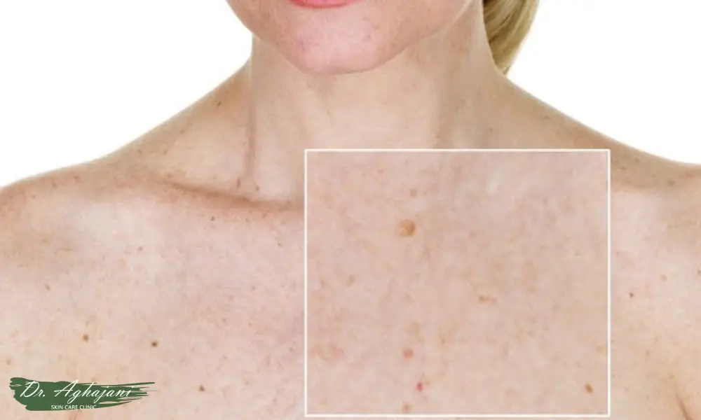 لکهای نامنظم کمرنگ/پررنگ