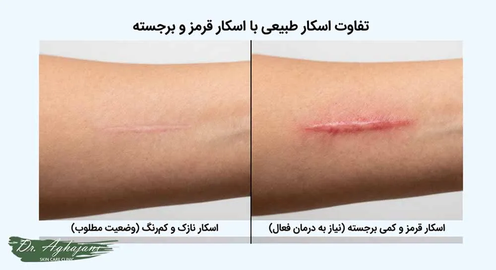 اسکار