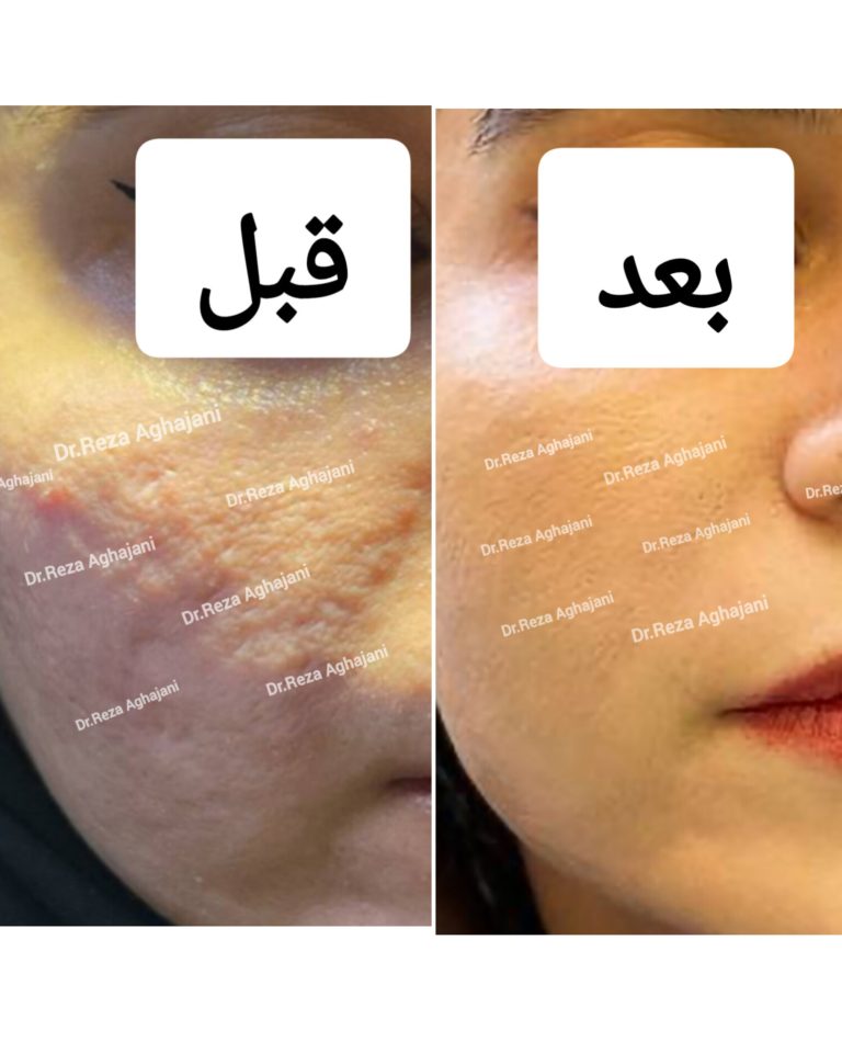جوش