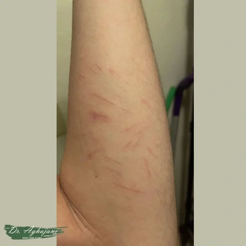 اسکار با تغییر رنگ