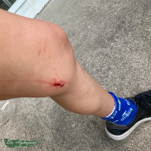 اسکار با تغییر رنگ